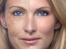 6 причин старения кожи