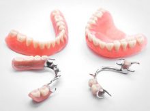 Методики протезирования в стоматологической клинике