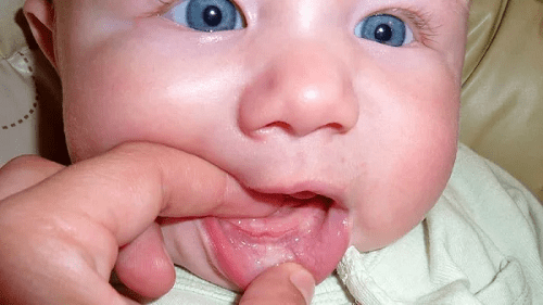 Первая помощь ребёнку, когда режутся зубки