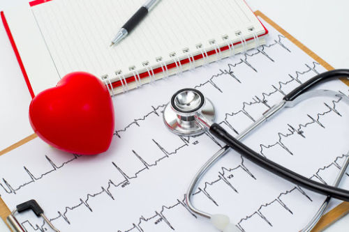 5 важных фактов о сердечной аритмии