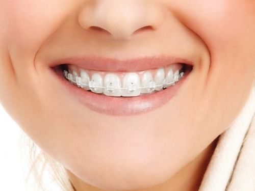Ортодонтическое лечение и другие стоматологические процедуры