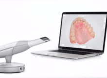 Цифровое сканирование зубов - инновационный метод в стоматологии